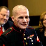 Marine Jumped on Grenade To Save Friends – He’s Now Inspiring The World