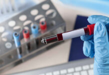 AI-Powered Blood Test Could Revolutionize Parkinson’s Detection