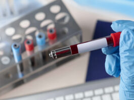 AI-Powered Blood Test Could Revolutionize Parkinson’s Detection