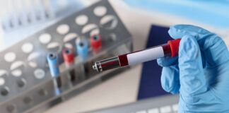 AI-Powered Blood Test Could Revolutionize Parkinson’s Detection