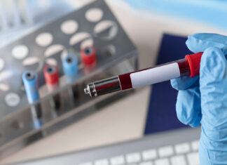 AI-Powered Blood Test Could Revolutionize Parkinson’s Detection